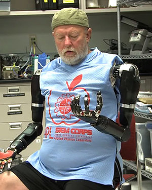Amazing Video of Double Amputee Controlling Robotic Arms