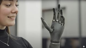 Check Out This Cool Robotic Prosthetic Hand That's Powered by AI